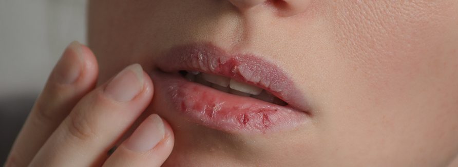 Zaburzenia obsesyjno-kompulsyjne i związane z nimi zaburzenia_-1